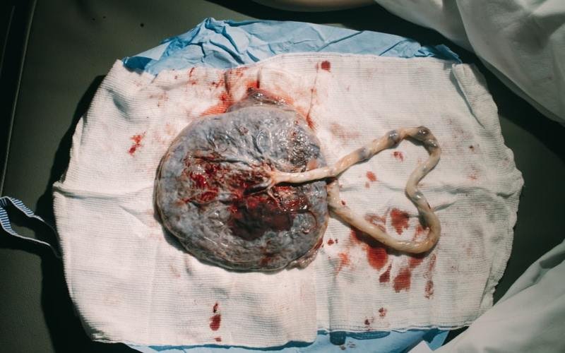 placenta/ afterbirth of a newborn baby